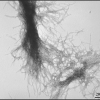 Meet the enemy: neutron ray reveals HD protein structure