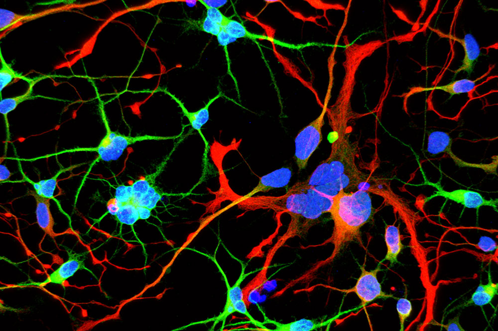 An early role for the Huntington's disease gene â but don't believe all the headlines