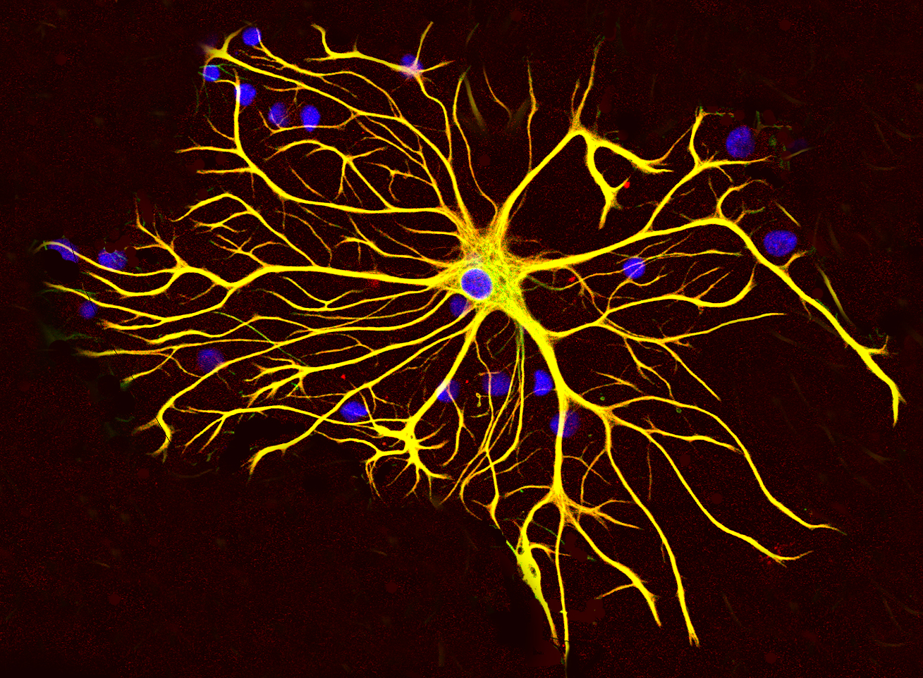 2024 HDBuzz Prize: Beyond nerve cells â who are the other players in the HD brain?