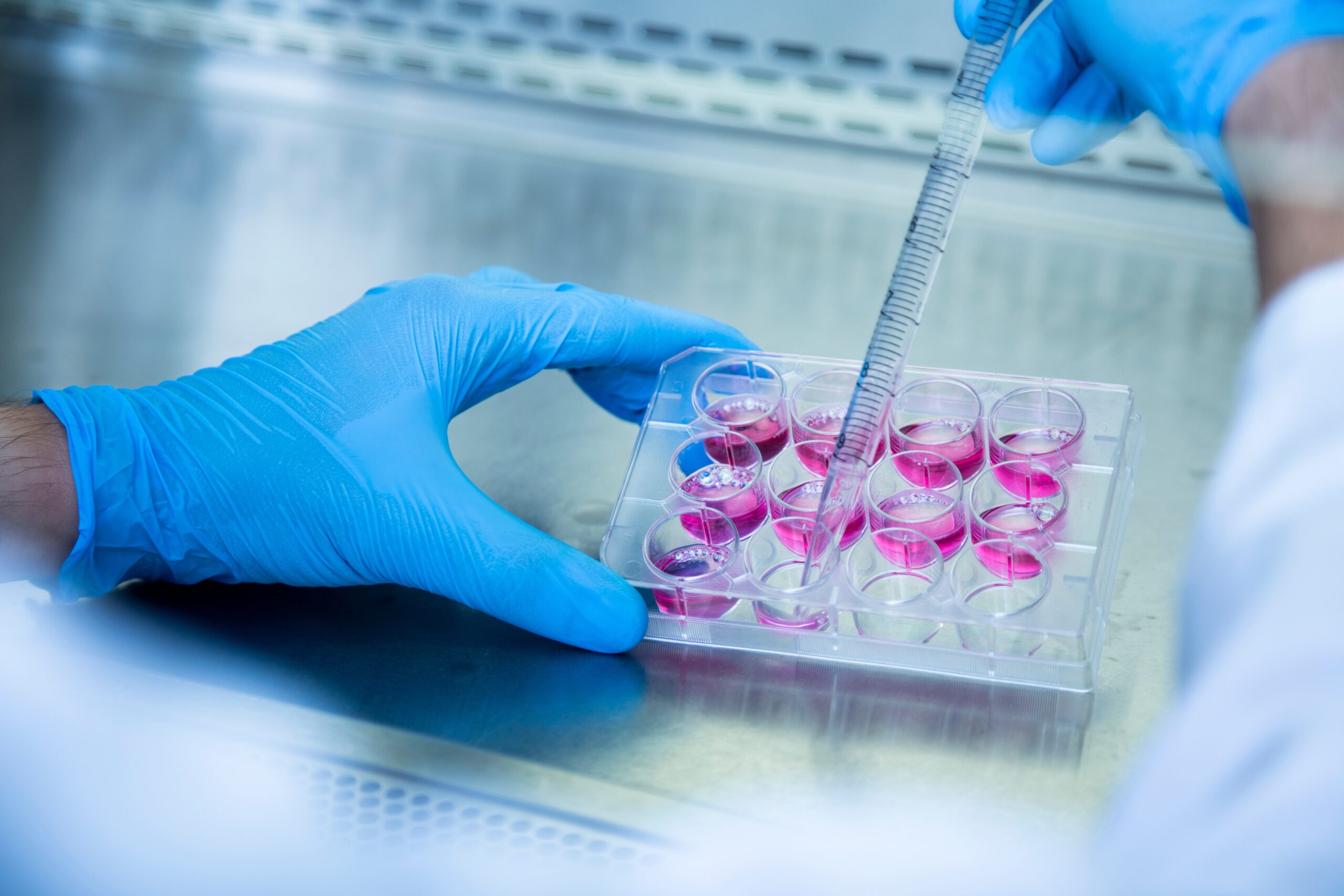 Mini brains grown in a dish shed light on Huntingtonâs disease and how we might treat it